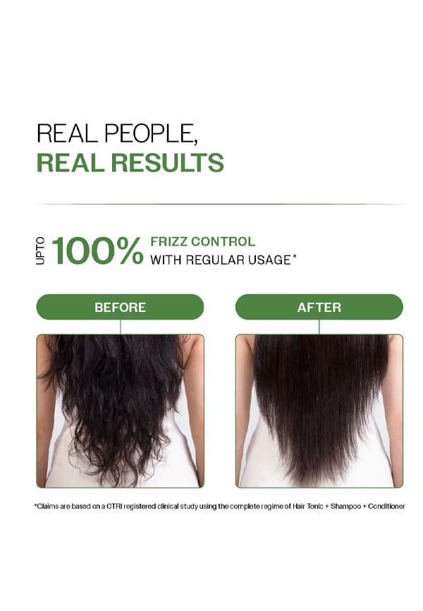 Anti-Dandruff Conditioner with Rosemary & Biotin – thumbnail 4