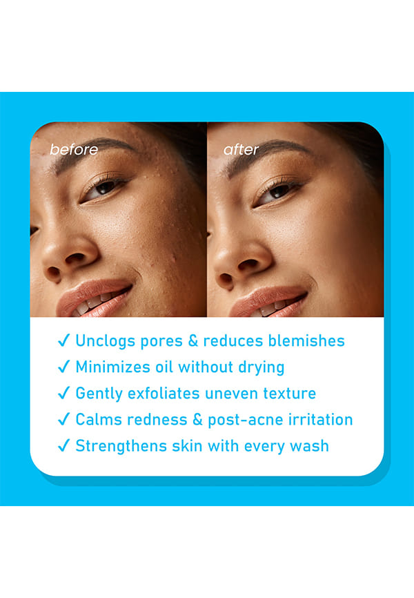Foaming Face Wash Enriched With Niacinamide – thumbnail 5