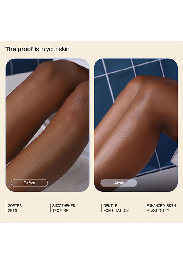 Smoothening Body Lotion | Reduces Bumps, Strawberry Skin and Keratosis Pilaris | With Glycolic, Lactic & Salicylic Acid | Dermatologically Tested | For All Skin Types | For Men & Women | 250 ML – thumbnail 3