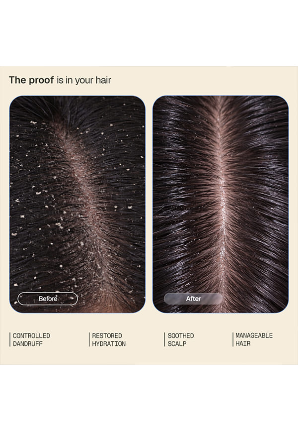 Anti-Dandruff Conditioner | Hydrates Scalp & Strands | Reduces Dandruff – thumbnail 4