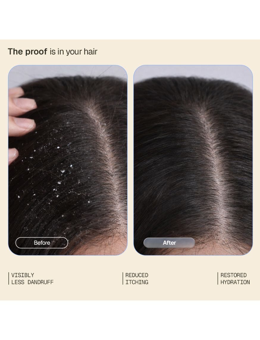 Anti Dandruff Detox Duo For Normal To Oily Hair | Anti Dandruff Shampoo And Conditioner – thumbnail 4