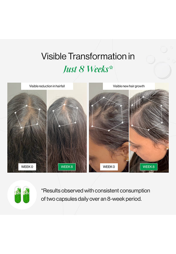 Hair Rescue, Hair Aminos, Vitamins, DHT Blocker for Hairfall Control & Growth – thumbnail 7