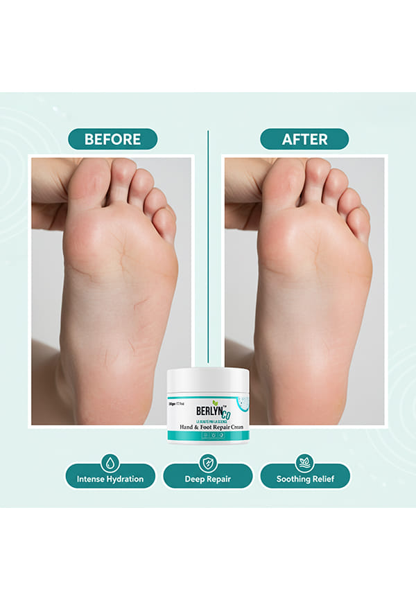 Hand & foot repair cream – thumbnail 6