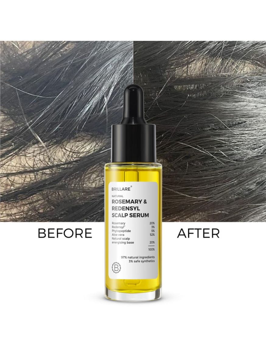20% Rosemary & 3% Redensyl Hair Growth Serum with 5% Phytopeptide – thumbnail 5