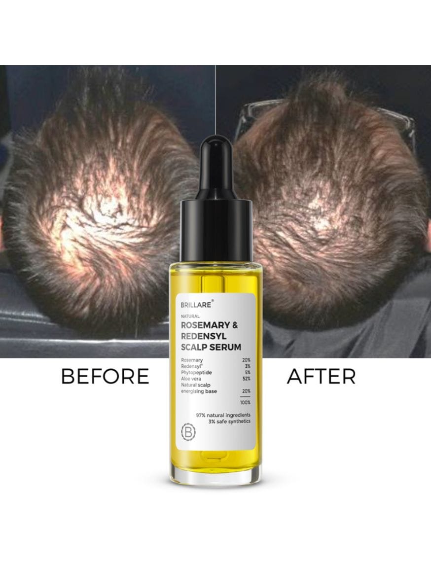 20% Rosemary & 3% Redensyl Hair Growth Serum with 5% Phytopeptide – thumbnail 8