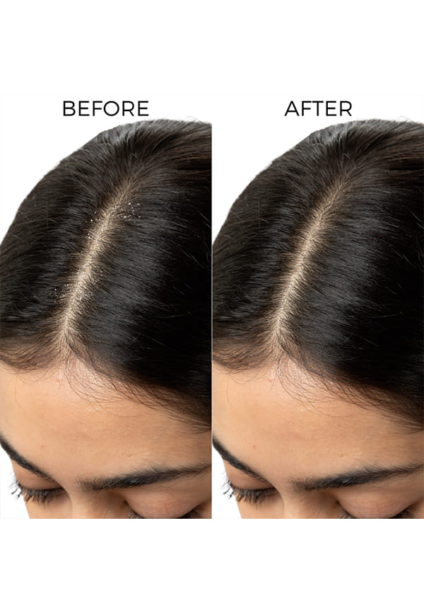 Lctylate Shampoo – thumbnail 5