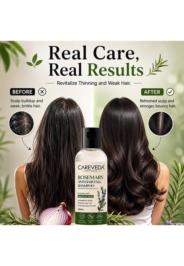 Rosemary Anti Hair Fall Shampoo – thumbnail 5