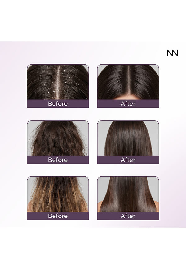 Red Algae Extract Anti Dandruff Hair Mask – thumbnail 7