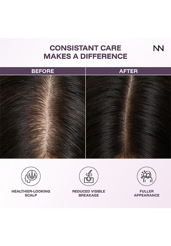 Ginger Anti Hair Loss & Strengthening Shampoo – thumbnail 7