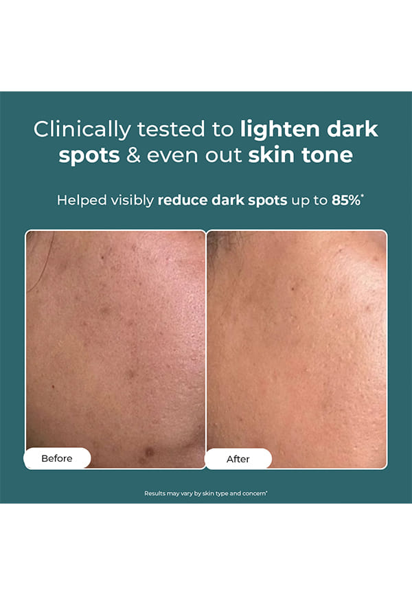 Pigmentation Corrector Moisturiser For Dark Spots – thumbnail 2