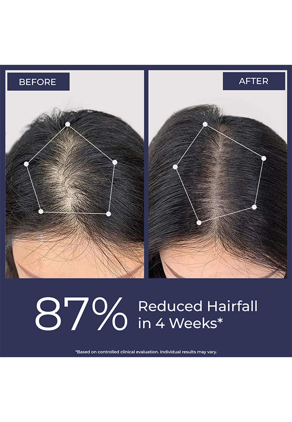 Full Strength Hair Growth Serum – thumbnail 2