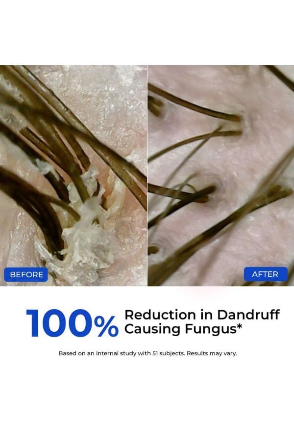 Pre-Wash Scalp Exfoliator – thumbnail 7