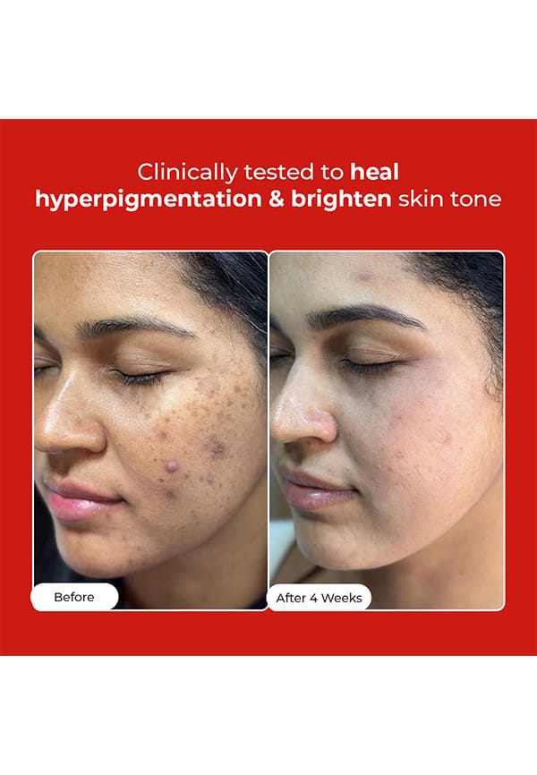 Rapid Glow & Brightening Essence – thumbnail 2