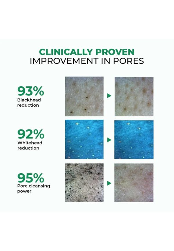 Zero Pore Ultra Light Oil Cleanser – thumbnail 5