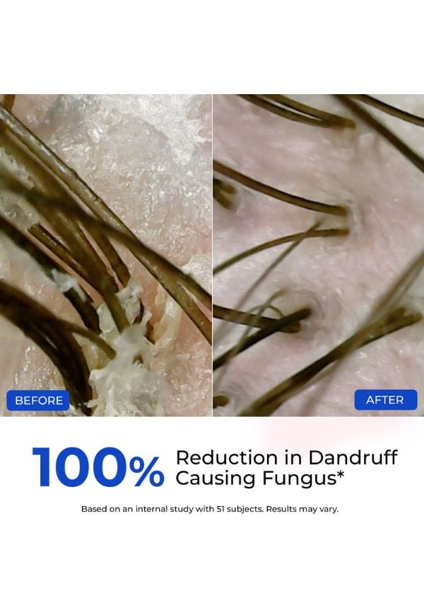 Anti-Dandruff Shampoo – thumbnail 8
