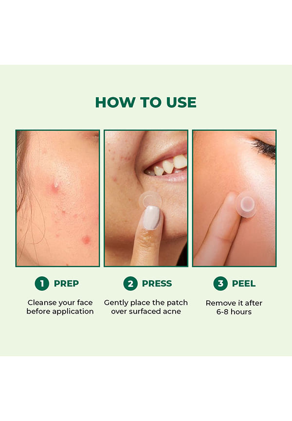 Self Dissolving Acne Clearing Patch – thumbnail 9