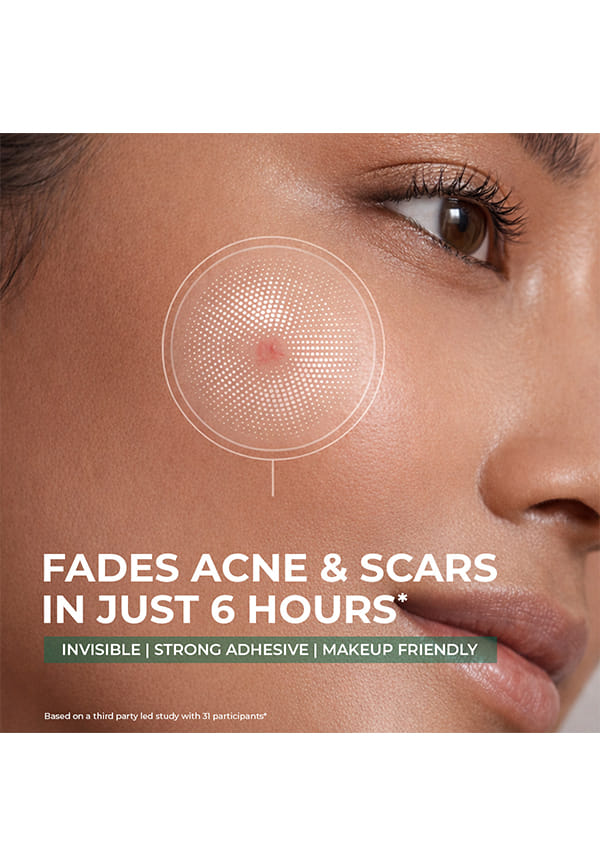 Self Dissolving Acne Clearing Patch – thumbnail 4