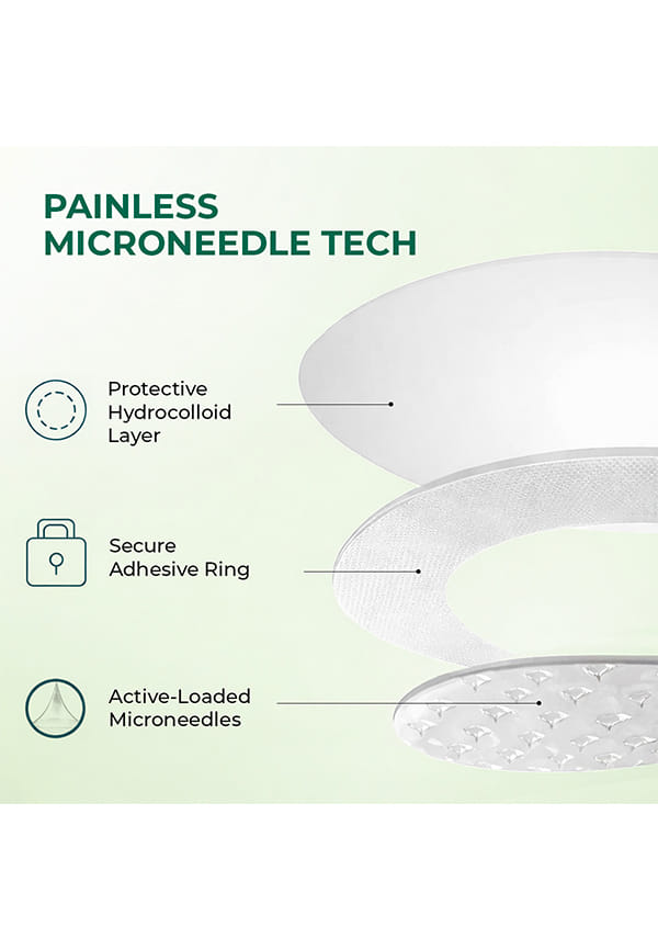 Self Dissolving Acne Clearing Patch – thumbnail 5