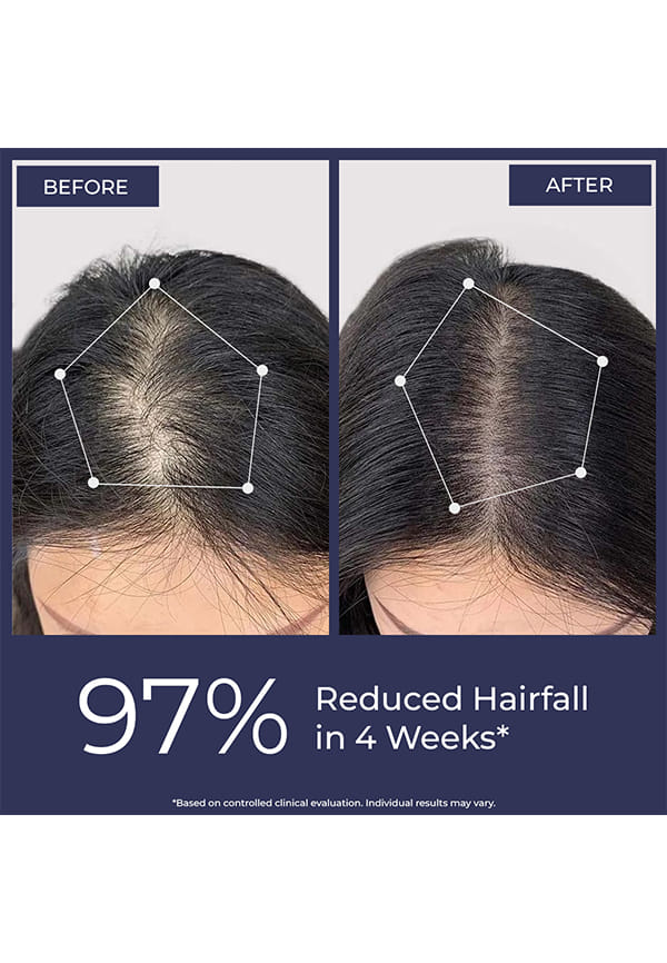 Full Strength Anti-Hairfall Post Wash Rosmeary Spray – thumbnail 2