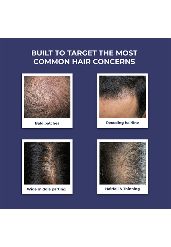 Full Strength Anti-Hairfall Post Wash Rosmeary Spray – thumbnail 5