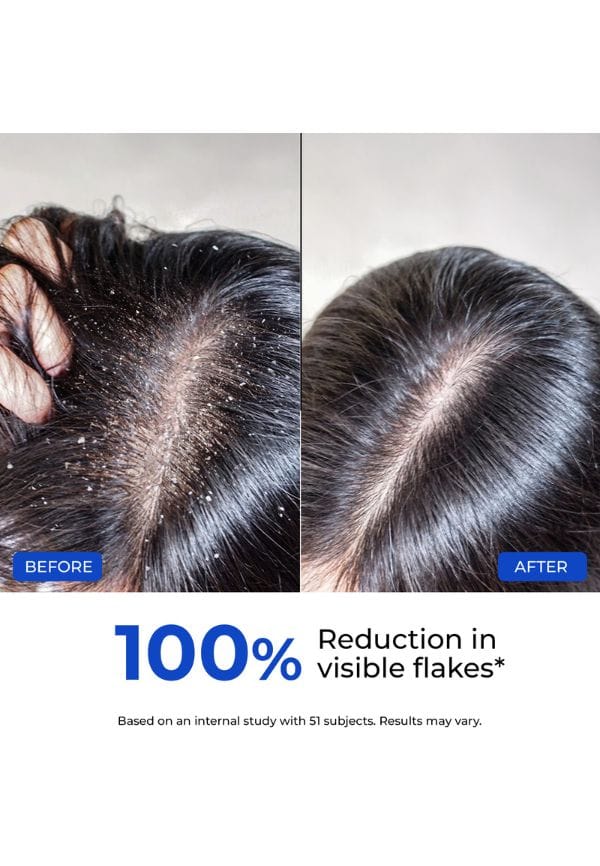 Anti-Dandruff Conditioner – thumbnail 7