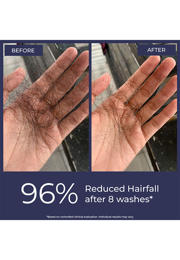 Full Strength Anti-Hairfall Shampoo – thumbnail 2
