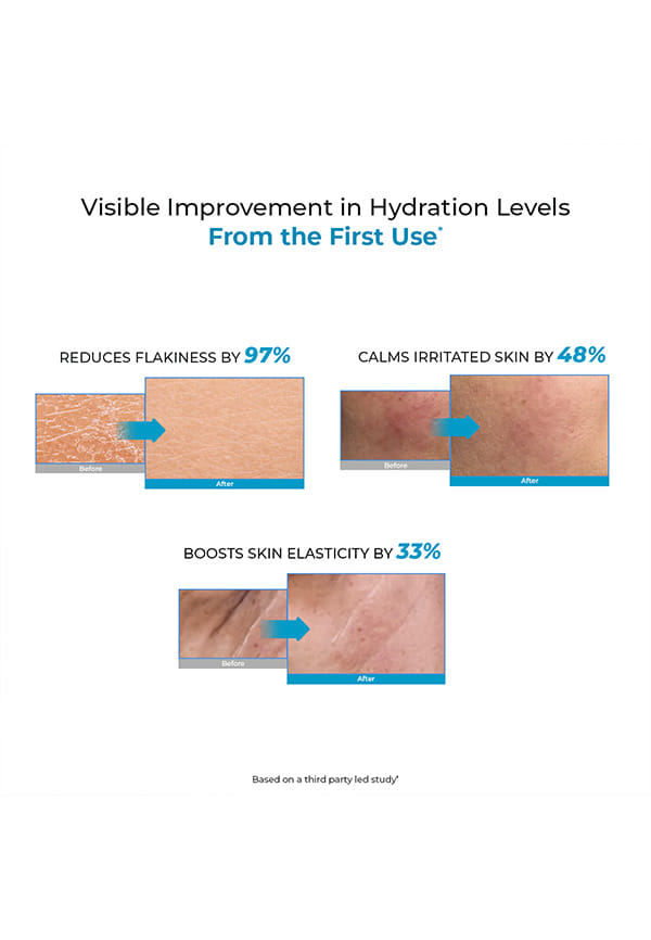Hydro+ 1% Hyaluronic Acid Serum for Dry Skin – thumbnail 4