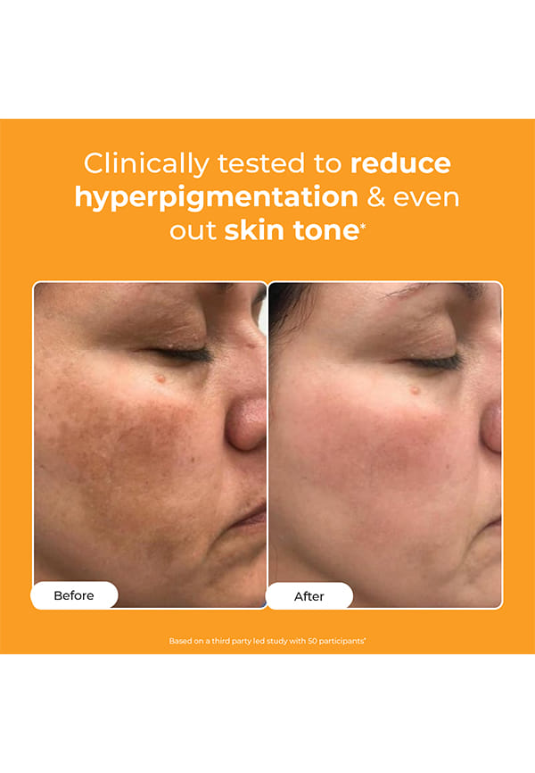 10% Vitamin C Face Serum (Advanced) With Ferulic Acid – thumbnail 8