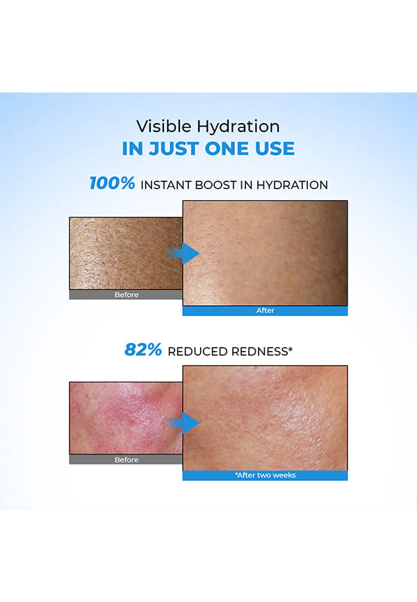 Hyaluronic Acid Lightweight Gel Cream with Ceramides – thumbnail 4