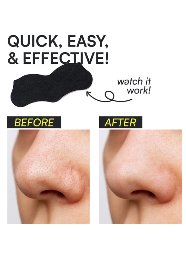 Charcoal nose strips – thumbnail 7