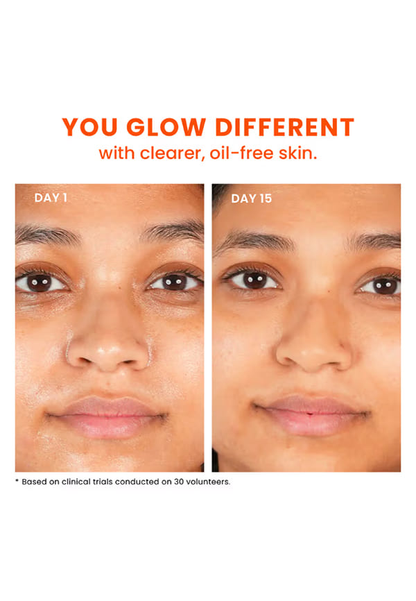 Oil Balancing Moisturizer | Pack of 2 – thumbnail 12