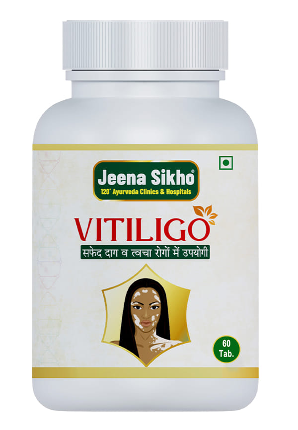 Vitiligo Tablets Vitiligo Tablets