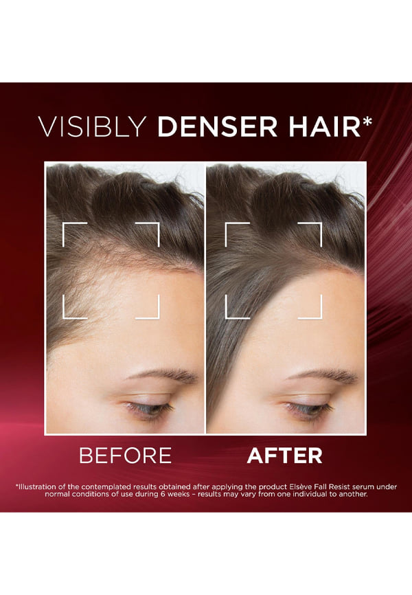 Fall Resist Anti Hair Fall Serum – thumbnail 5