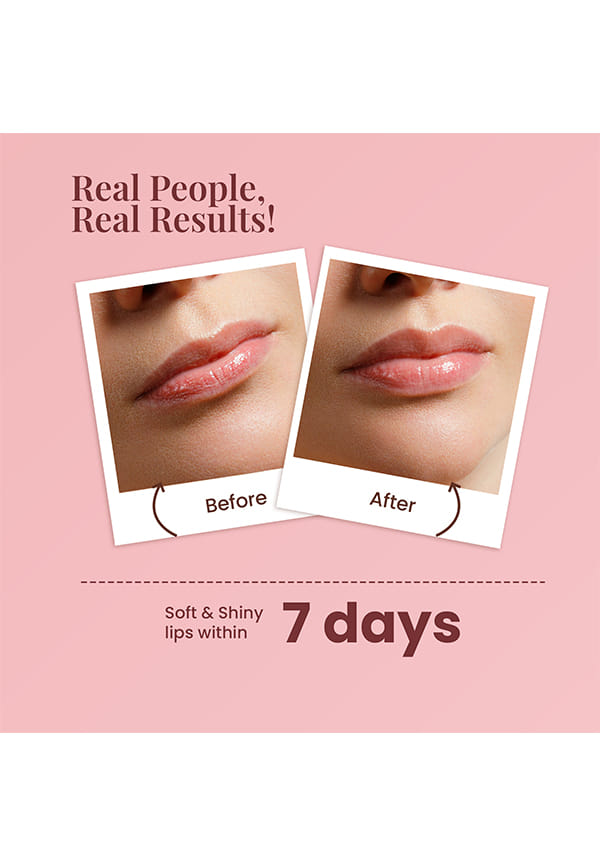 Strawberry Lip Care with White Haldi for Shiny & Natural Tint – thumbnail 2