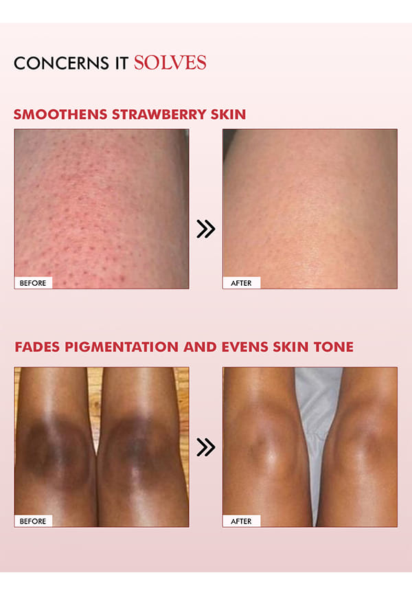 11% AHA-BHA Skin Smoothening Strawberry Body Lotion – thumbnail 4