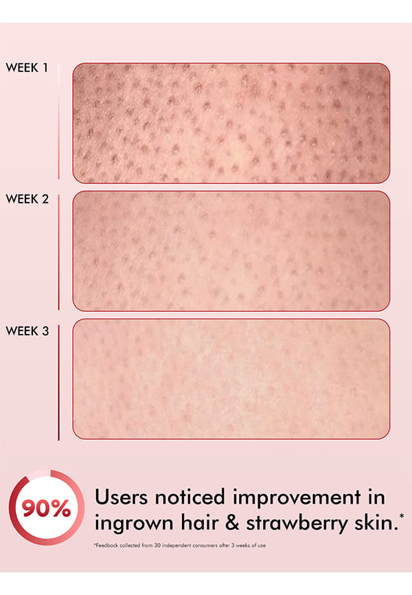 11% AHA-BHA Skin Smoothening Strawberry Body Lotion – thumbnail 5