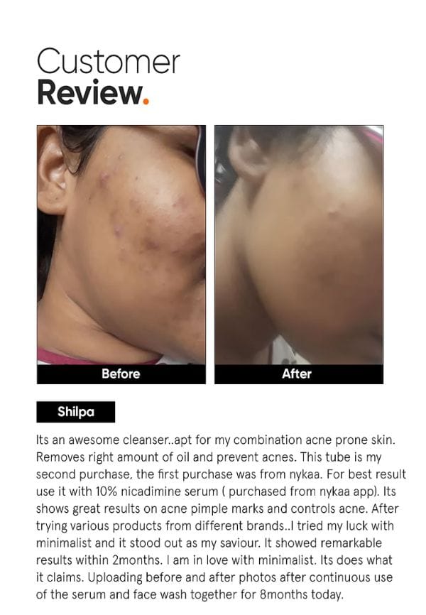 2% Salicylic Acid Face Wash For Oily Skin – thumbnail 5