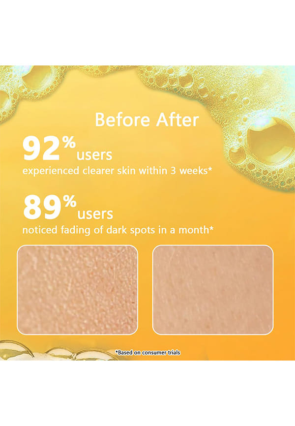 Vitamin C Face Wash, Brightening & Evening Skin Tone – thumbnail 5