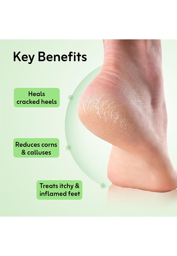 Crack Heel Repair Cream – thumbnail 3