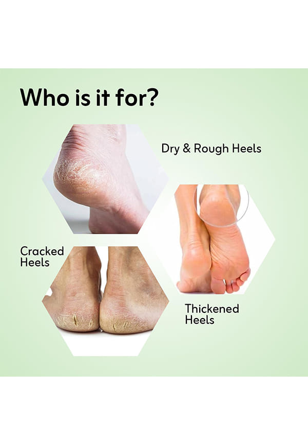 Crack Heel Repair Cream – thumbnail 5