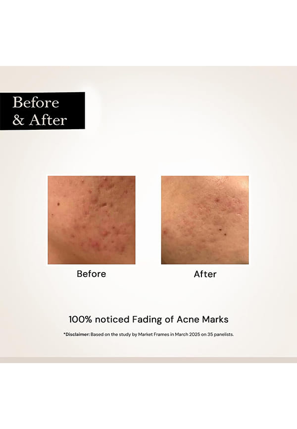 Face Glow Night serum for Glowing skin – thumbnail 5
