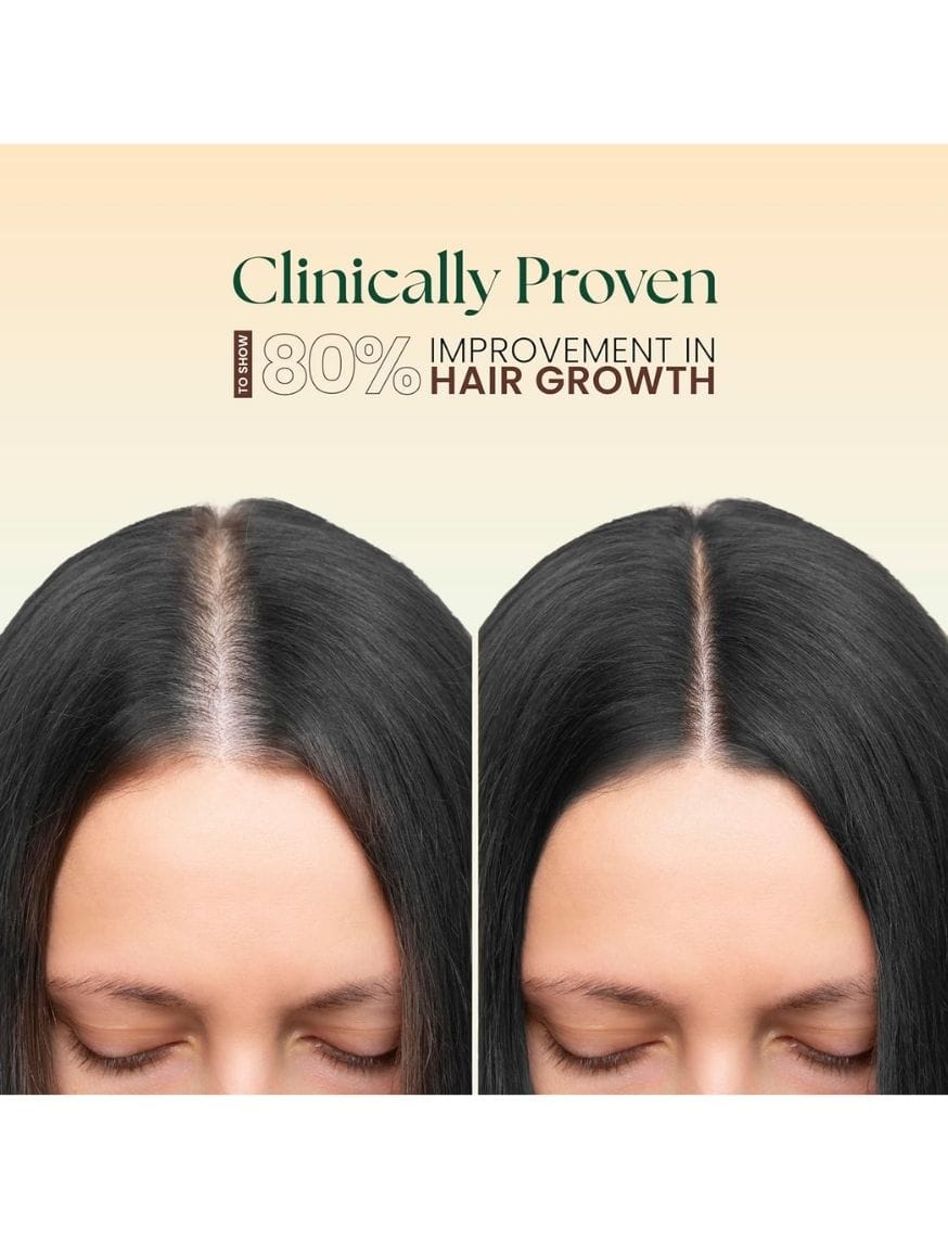 5 In 1 Hair Oil – thumbnail 3