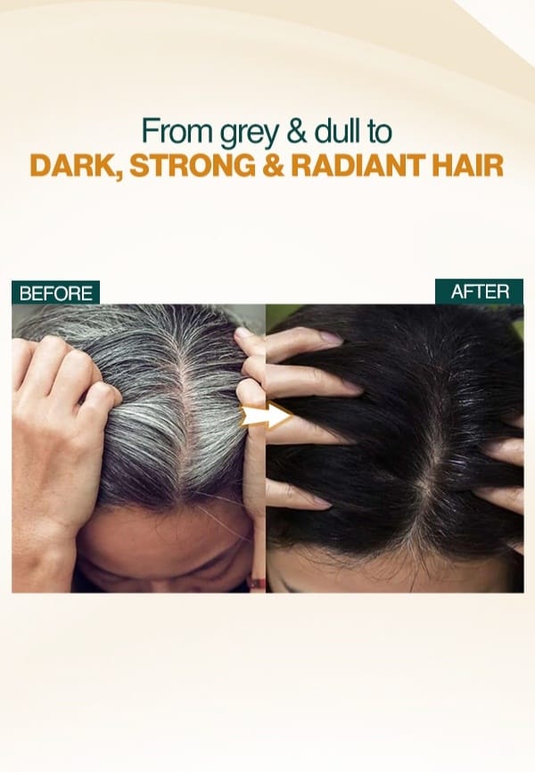 Anti-Greying Rice Water Serum to Stop Premature Hair Greying - 50 ml – thumbnail 2