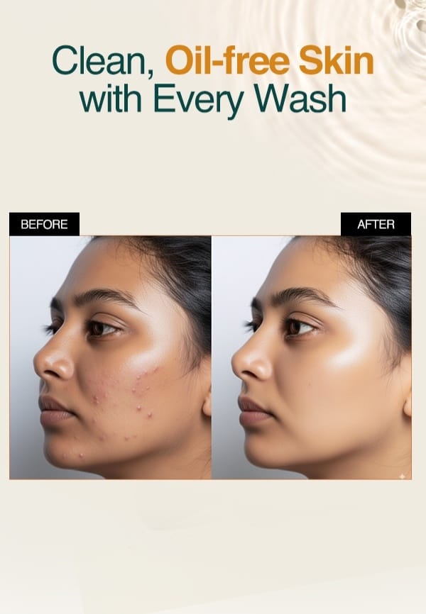 Ratrani Moroccan Lava Face Wash for Deep Pore Cleansing - 100 ml – thumbnail 2