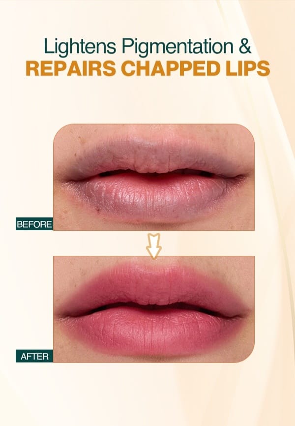 Rose Repair Lip Balm for Dry, Chapped and Dark Lips - 12 gm – thumbnail 2