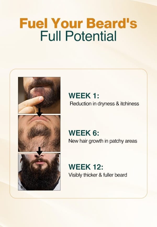 Advanced Beard Growth Oil Serum for Fuller and Thicker Beard Growth - 30 ml – thumbnail 4