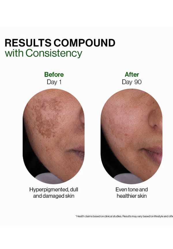 Bioactive Gluta with L-Glutathione to Reduce Pigmentation Tablets, Strawberry – thumbnail 7