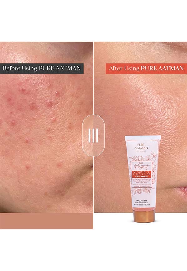 vitamin -C for women girls men bright glowing skin with Natural Vitamin- C – thumbnail 3