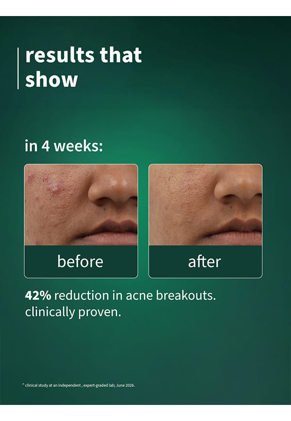 SebaClear™ Mattifying Gel Crème – thumbnail 5