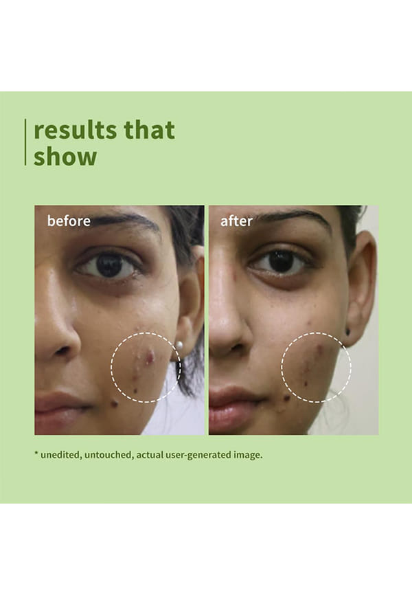 Green Tea Pore Cleansing Face Wash For Oily Skin – thumbnail 3